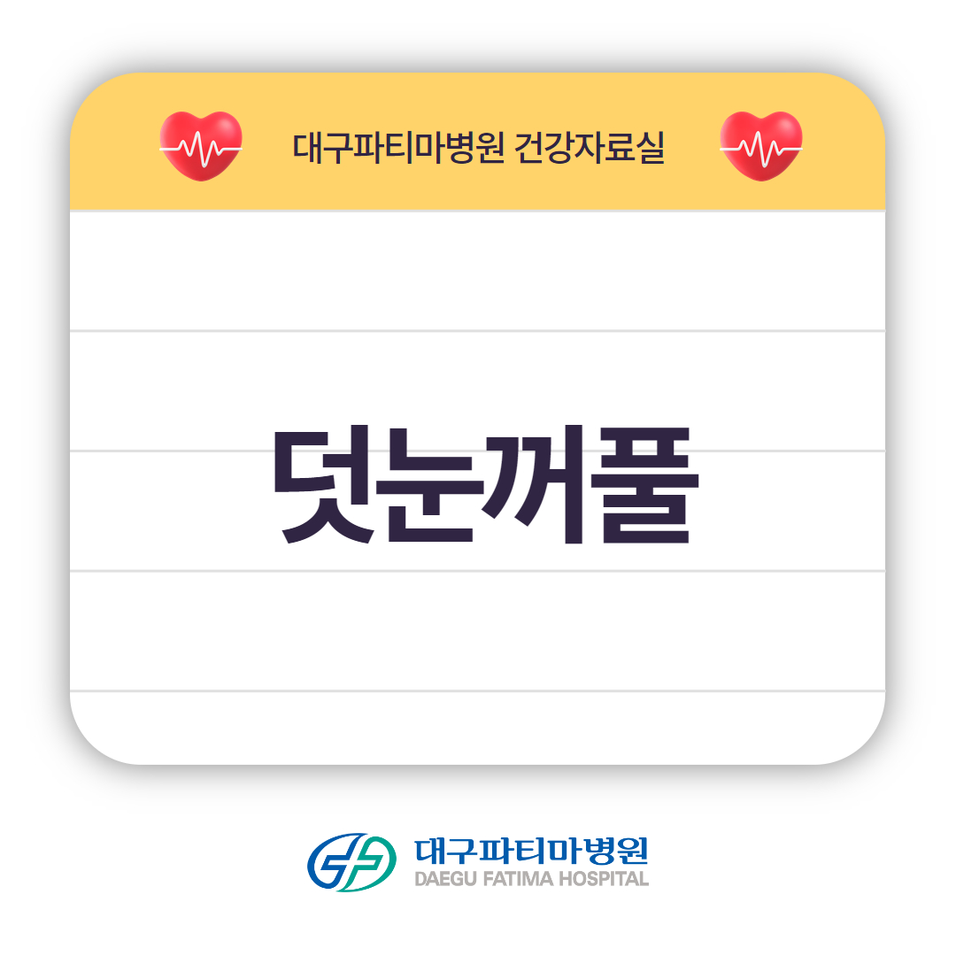 덧눈꺼풀 관련이미지